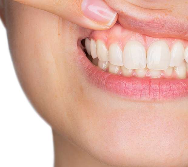 Boca Raton Gum Disease