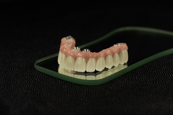 Implant Supported Dentures Vs Traditional Dentures