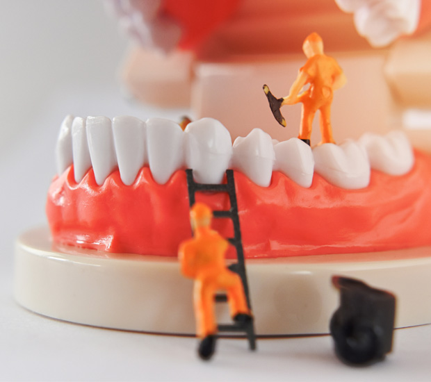 Boca Raton Mini Dental Implants