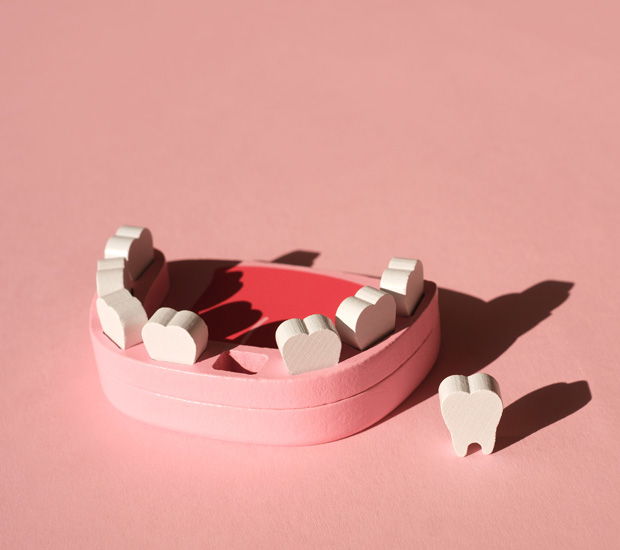 Boca Raton Periodontal Tooth Loss