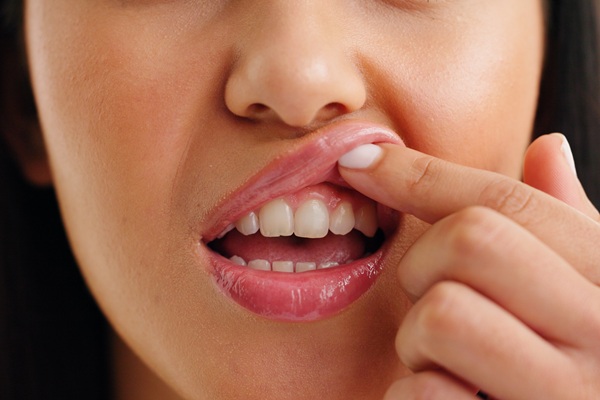 Periodontists Specialize In Soft Tissue: Gums And Cheeks