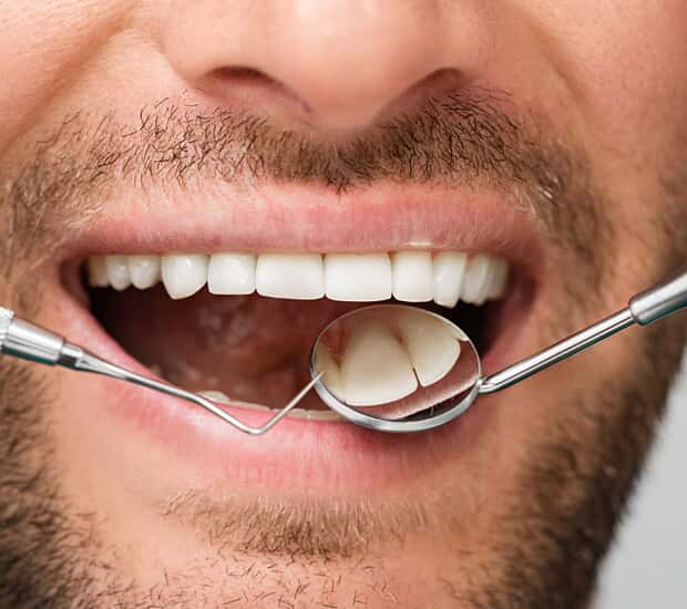 Boca Raton Periodontitis