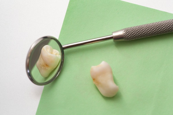 Are Tooth Extractions Painful?